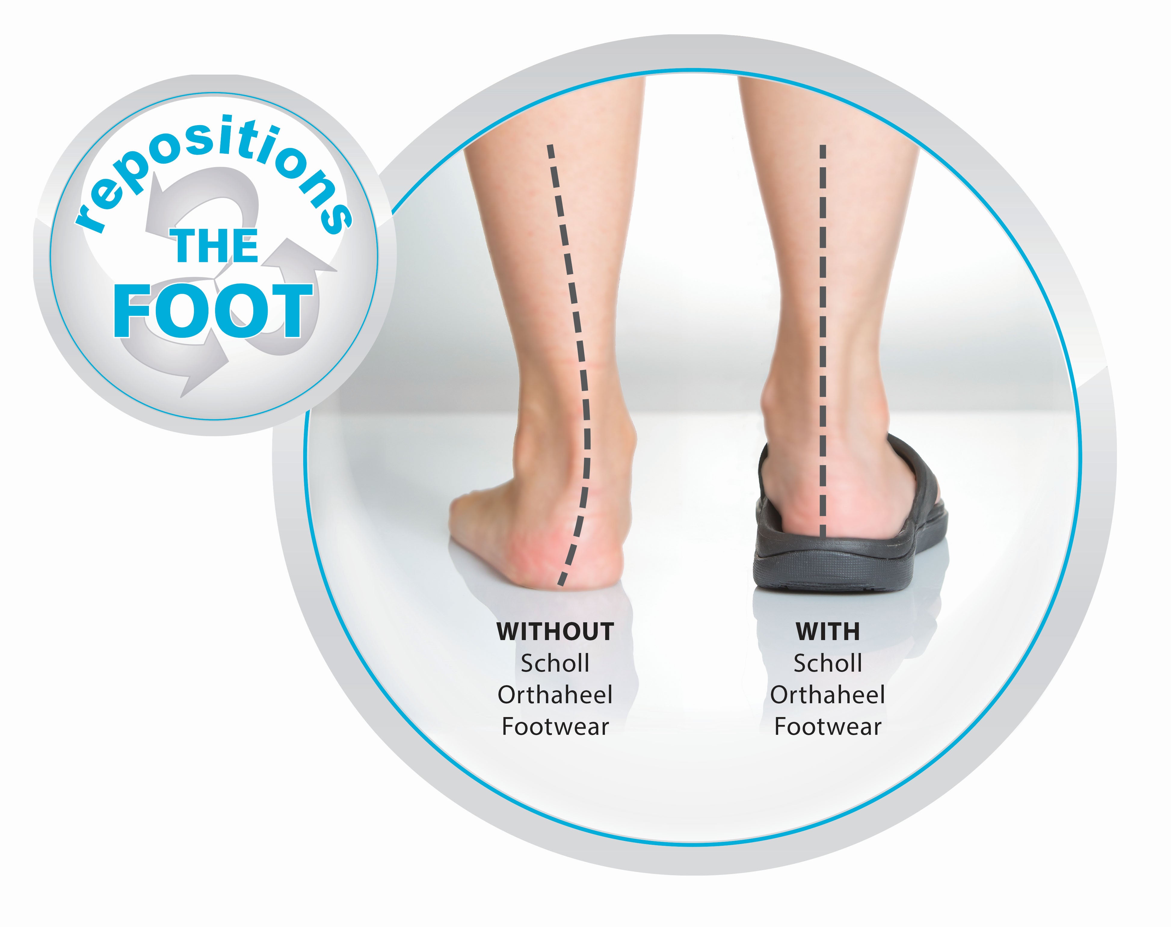 Scholl Orthaheel Spree Womens Comfort Orthotic Sandal Slides